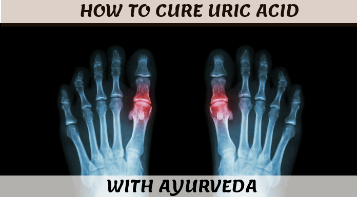 What is Uric Acid And How To Control It With Ayurveda Feature Image